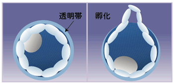 孵化補助術（AHA）