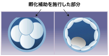 孵化補助術の方法