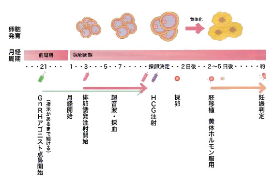 ロング法での体外受精スケジュール