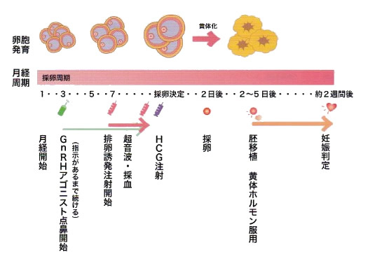 ショート法での体外受精スケジュール