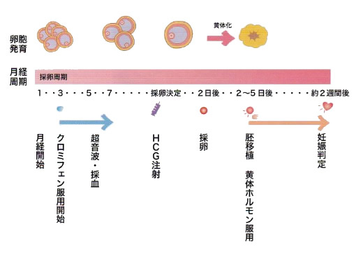 自然周期法（クロミフェン）での体外受精スケジュール