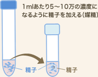 一般体外受精法